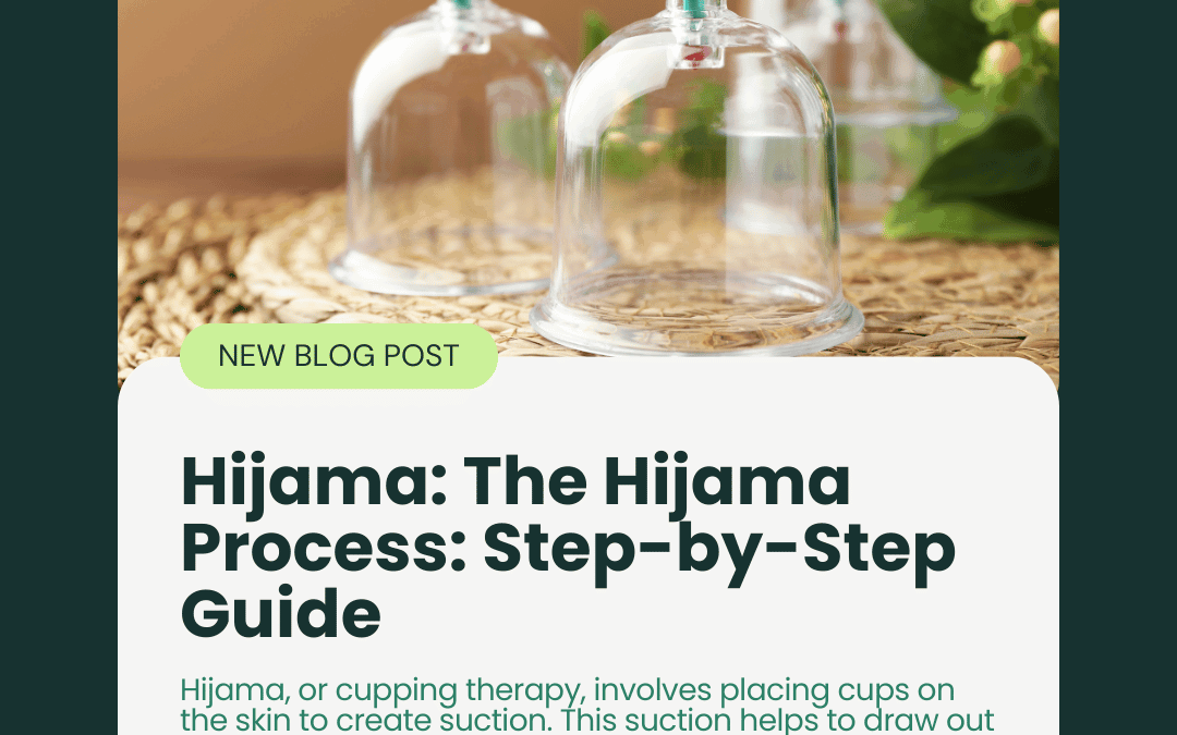Hijama